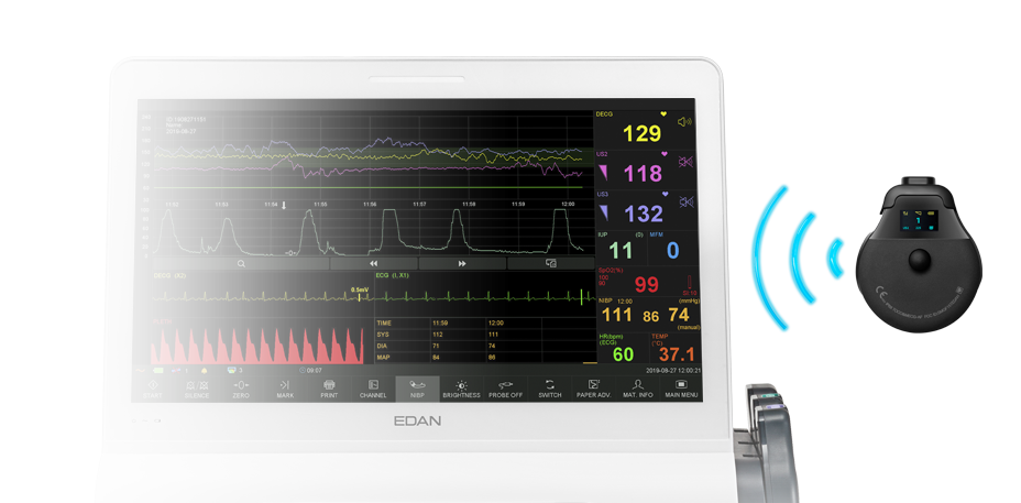 Edan 15/F15Air - Image 3