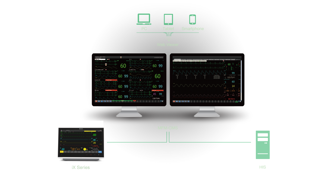 Edan iX Series - Image 2