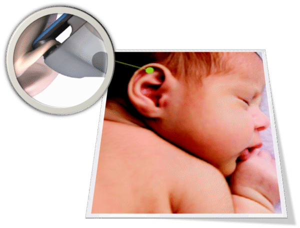 Bilicare Bilirubin Monitor - Image 2