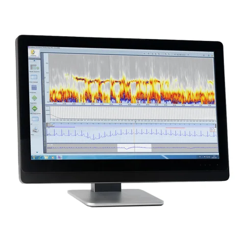 Schiller Medilog Darwin 2