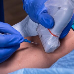 Envision™ Ultrasound Probe Covers & Scanning Pads