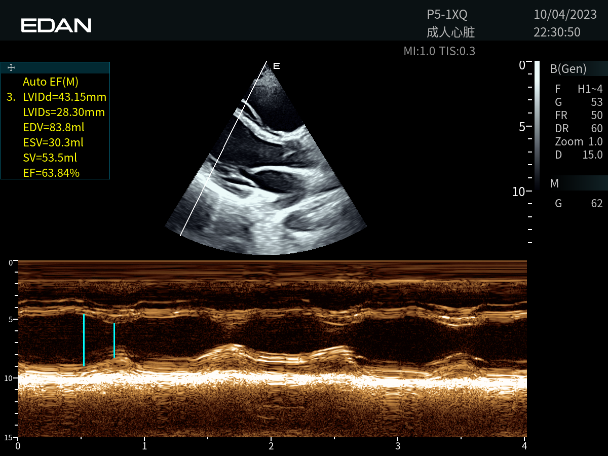 Edan Acclarix AX9 Portable Ultrasound - Image 3