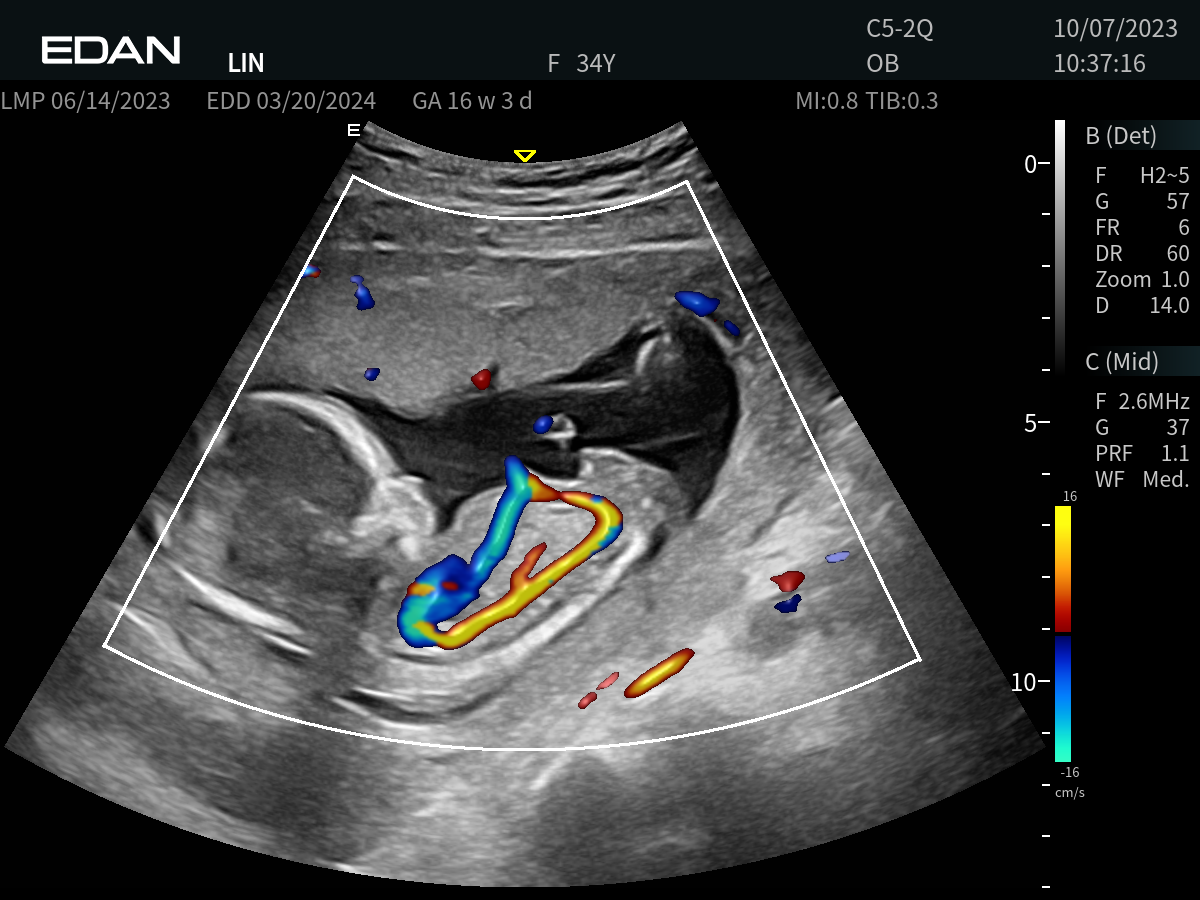 Edan Acclarix AX9 Portable Ultrasound - Image 6
