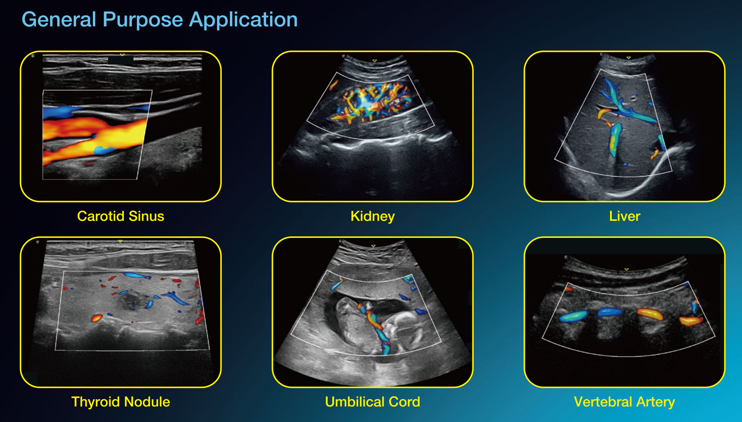 Edan Acclarix AX9 Portable Ultrasound - Image 2