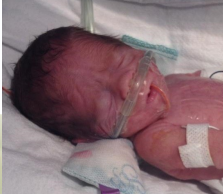 Neck Roll - Small Beginnings